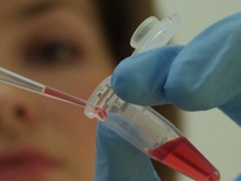 В 2012 году в Саратовской области выросло число заразившихся ВИЧ