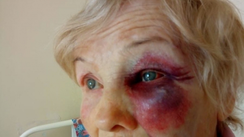 Факт драки между чиновником и его бывшей тещей проверяют полицейские