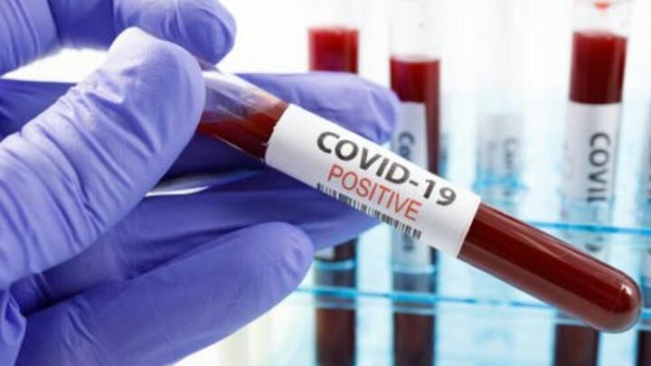 Переболевшие коронавирусом входят в группу риска по болезни Паркинсона