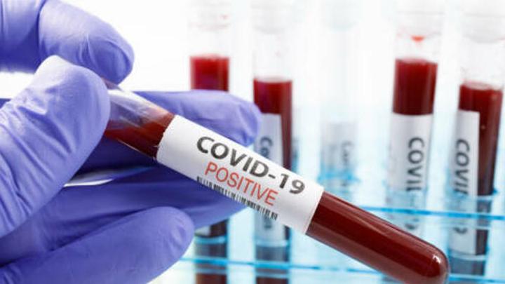 За сутки 331 житель Саратовской области заболел коронавирусом