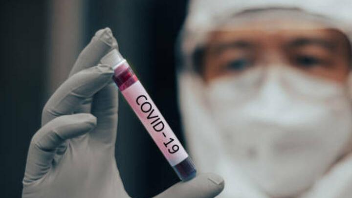 За неделю коронавирусом в Саратовской области заболели 73 человека