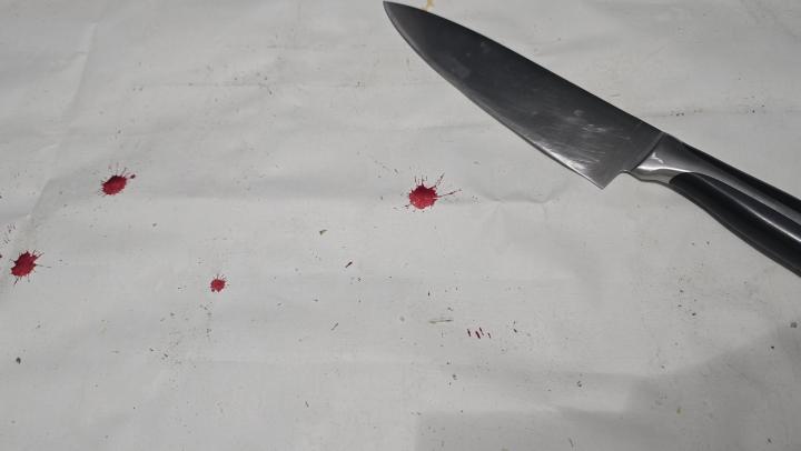 Житель Ртищевского района отправился подметать улицы за нападение с ножом  