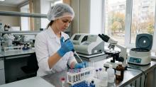 В Саратовской области число новых случаев ВИЧ выросло на 8,5%